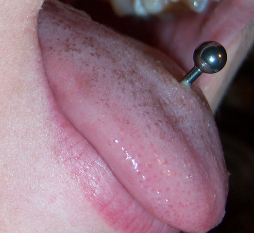 nyelv piercing fogyás